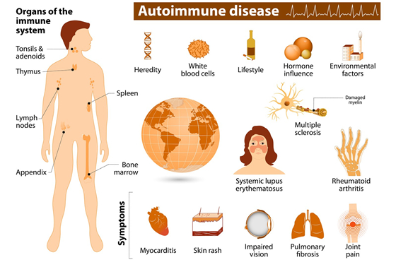 终生免疫疾病用什么药？7种终生免疫疾病新药研究现况一览