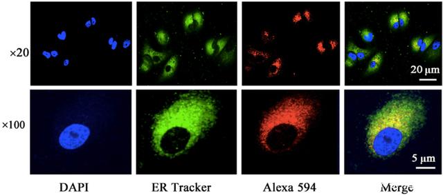 LCFA-Ex4 is mainly distributed in the endoplasmic reticulum of intestinal mucosal epithelial cells