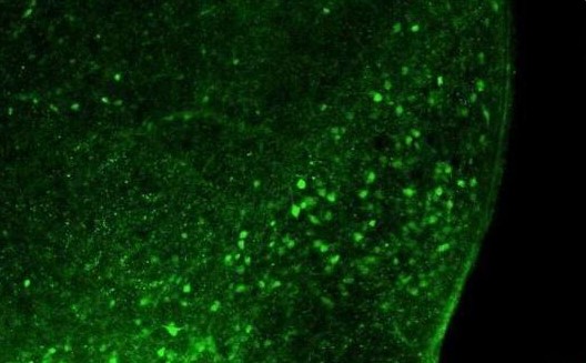 Neuron：特殊痛敏肽神经元竟会让人体对高脂肪食物十分偏爱