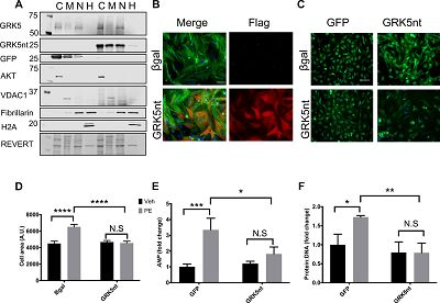 SciSignal:GRK5N尾端多肽可减轻过载心肌肥大和慢性心衰慢性心衰