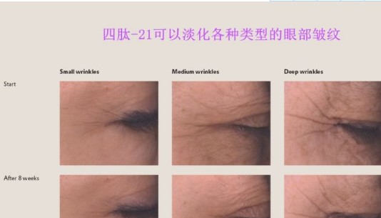 四肽-21（Tetrapeptide-21）除皱提升延展性